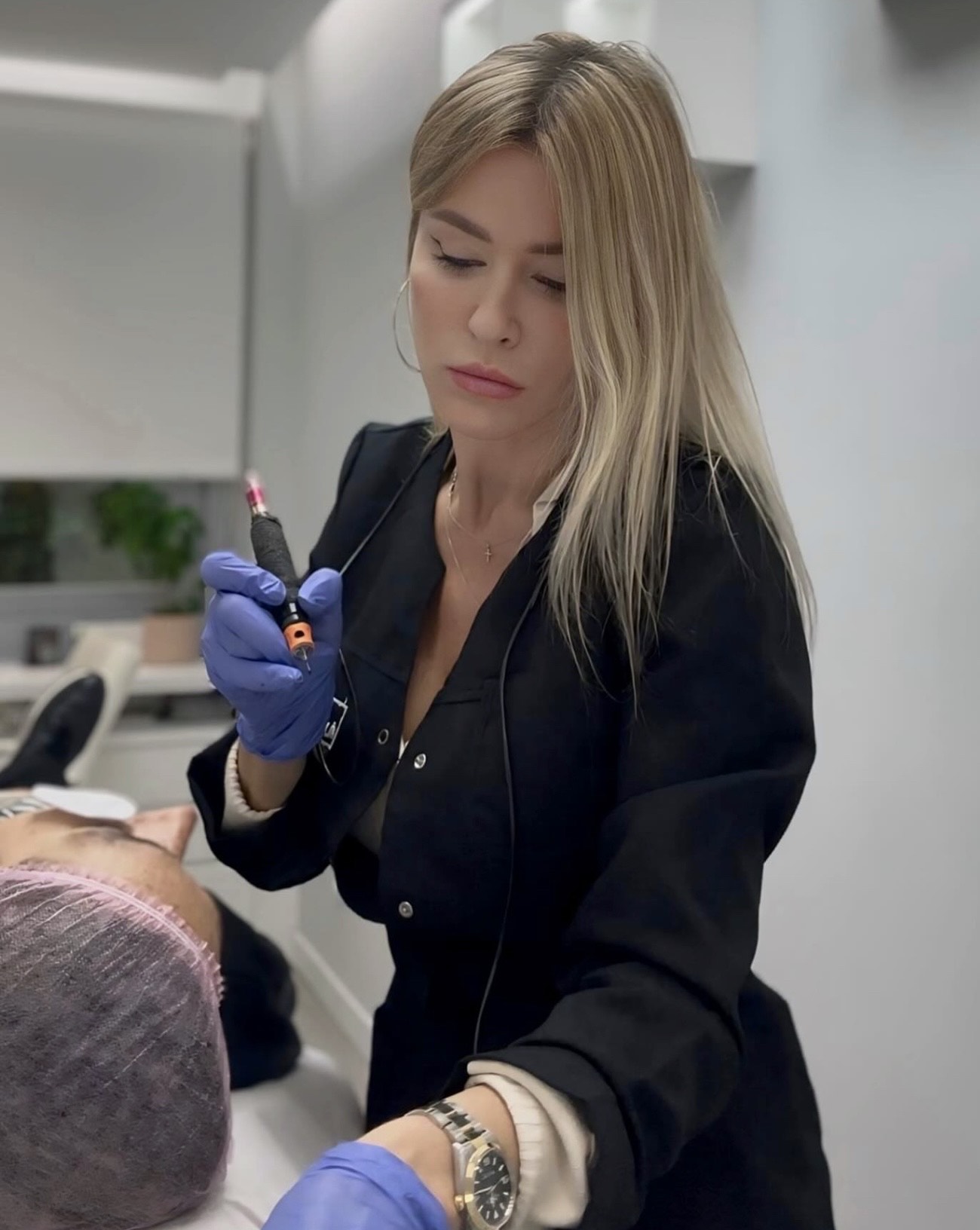 Micropigmentación capilar