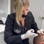 Micropigmentación capilar