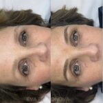 Micropigmentación Estética