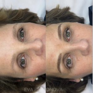 Micropigmentación Estética