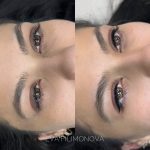 Micropigmentación Estética