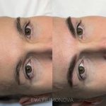 Micropigmentación Estética