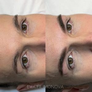 Micropigmentación Estética