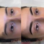 Micropigmentación Estética