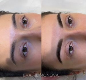 Micropigmentación Estética