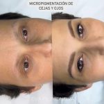 Micropigmentación Estética