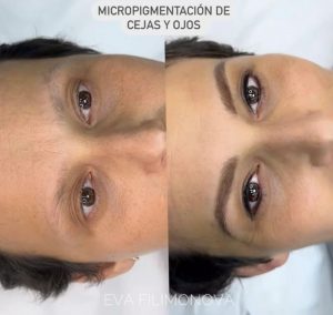 Micropigmentación Estética