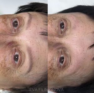 Micropigmentación Estética