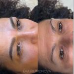 Micropigmentación Estética