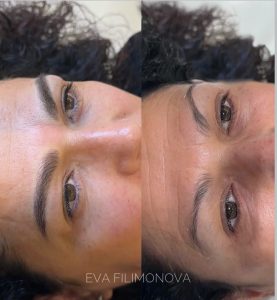 Micropigmentación Estética