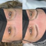 Micropigmentación Estética