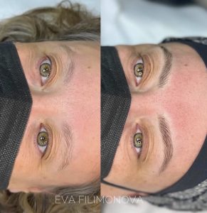 Micropigmentación Estética