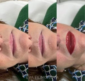 Micropigmentación Estética