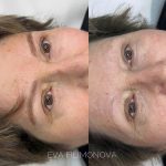 Micropigmentación Estética