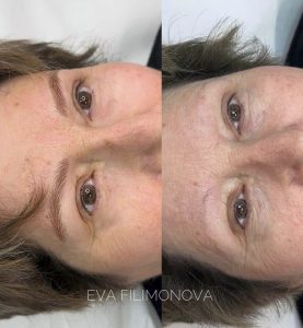 Micropigmentación Estética