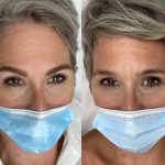 Micropigmentación Estética