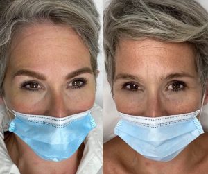 Micropigmentación Estética