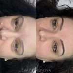 Micropigmentación Estética