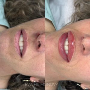 Micropigmentación Estética